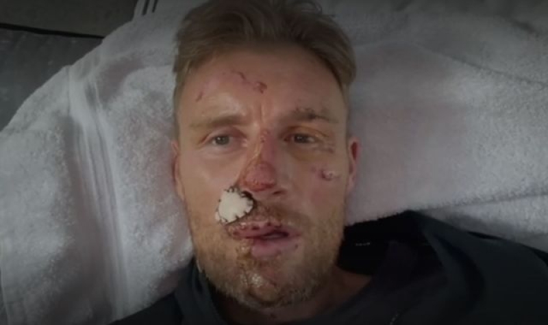 Freddie Flintoff reveals extent of injuries after Top Gear crash