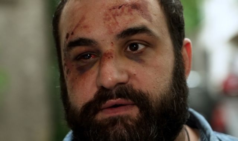 Georgian opposition politician beaten by hooded thugs blames &#039;Putin&#039;s puppets&#039;