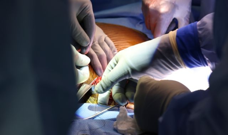 Patient who  had first ever pig kidney transplant dies two months after procedure